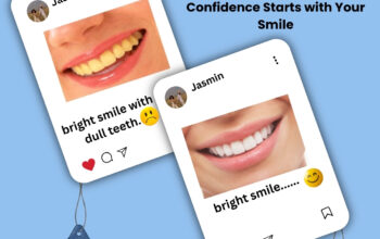 Best Dental Clinics in bangalore – Oncodermacentre