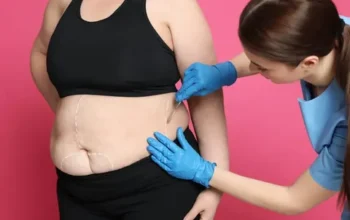 Bariatric surgery in Islamabad