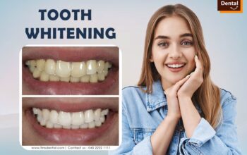 Dentist Near Charminar – FMS Dental Clinic in Koti