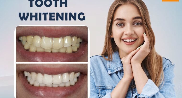 Dentist Near Charminar – FMS Dental Clinic in Koti