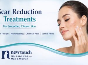 Scar Reduction Treatments: Effective Solutions